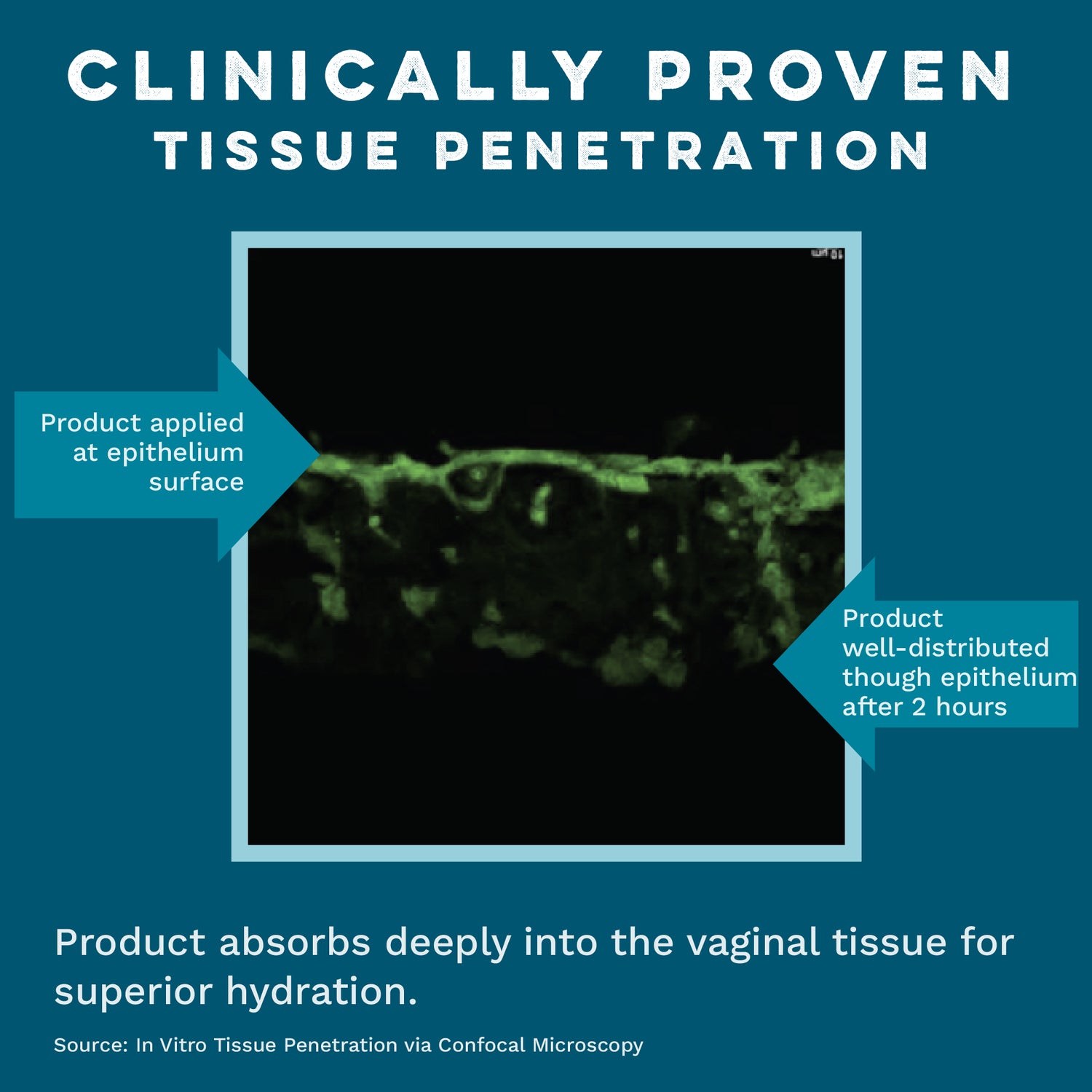 Vaginal Moisturizing Gel